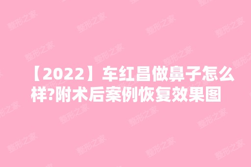 【2024】车红昌做鼻子怎么样?附术后案例恢复效果图+隆鼻2024收费价格