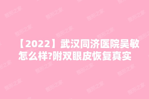 【2024】武汉同济医院吴敏怎么样?附双眼皮恢复真实效果前后对比案例效果太惊人啦