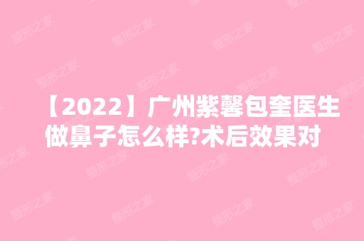 【2024】广州紫馨包奎医生做鼻子怎么样?术后效果对比图分享