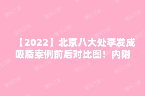 【2024】北京八大处李发成吸脂案例前后对比图！内附医生口碑点评和价格表