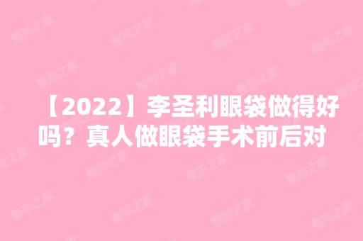 【2024】李圣利眼袋做得好吗？真人做眼袋手术前后对比图来袭~价格多少呢