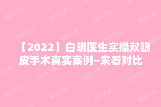 【2024】白明医生实操双眼皮手术真实案例~来看对比图哦