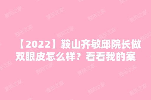 【2024】鞍山齐敏邱院长做双眼皮怎么样？看看我的案例~术后两个月效果很好哟！