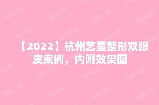 【2024】杭州艺星整形双眼皮案例，内附效果图