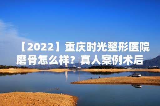 【2024】重庆时光整形医院磨骨怎么样？真人案例术后三个月效果展示