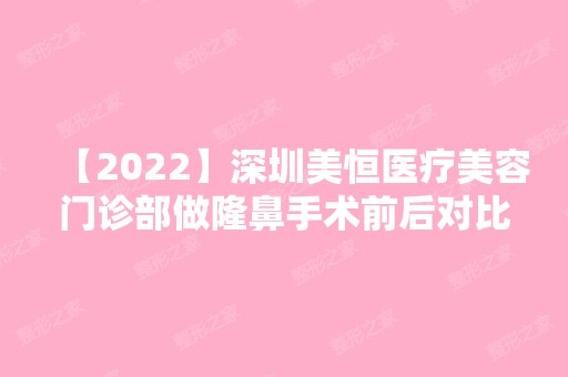 【2024】深圳美恒医疗美容门诊部做隆鼻手术前后对比照~来看案例