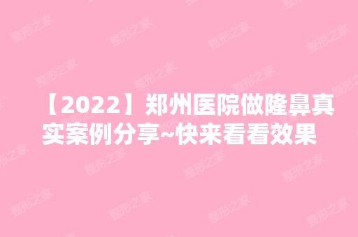 【2024】郑州医院做隆鼻真实案例分享~快来看看效果吧