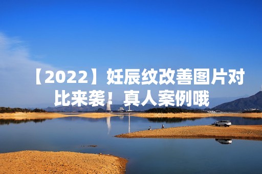 【2024】妊辰纹改善图片对比来袭！真人案例哦