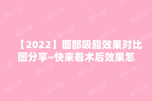 【2024】面部吸脂效果对比图分享~快来看术后效果怎么样？