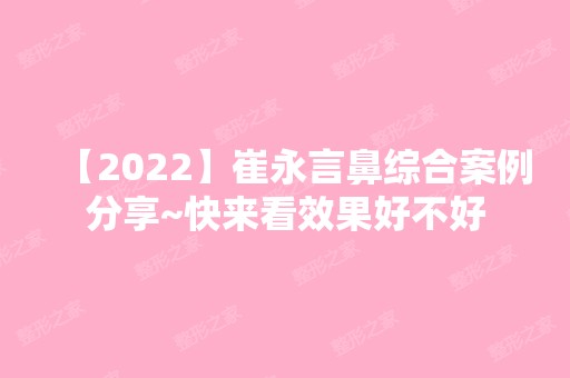 【2024】崔永言鼻综合案例分享~快来看效果好不好