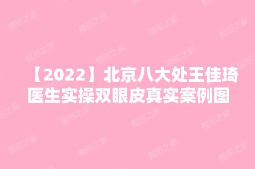 【2024】北京八大处王佳琦医生实操双眼皮真实案例图~手术前后差别大吗