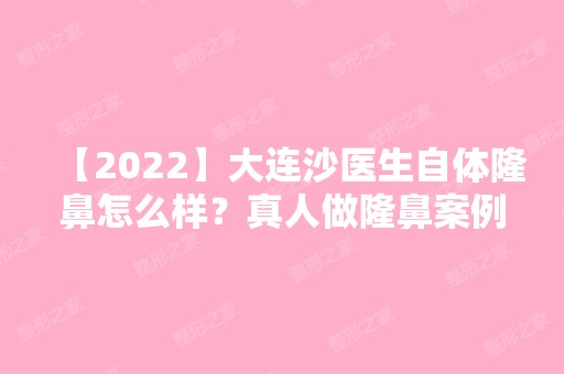 【2024】大连沙医生自体隆鼻怎么样？真人做隆鼻案例图！