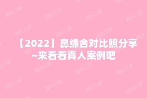 【2024】鼻综合对比照分享~来看看真人案例吧