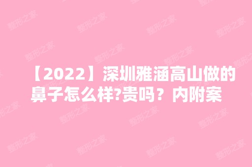 【2024】深圳雅涵高山做的鼻子怎么样?贵吗？内附案例分享