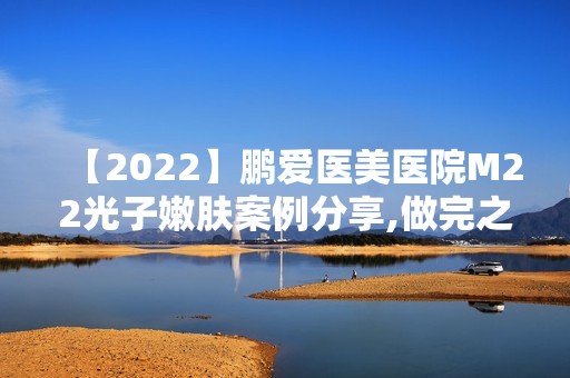 【2024】鹏爱医美医院M22光子嫩肤案例分享,做完之后脸上肌肤滑滑嫩嫩的！