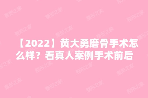 【2024】黄大勇磨骨手术怎么样？看真人案例手术前后对比就知道了