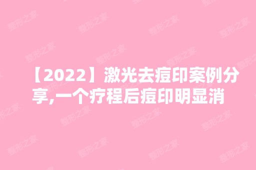 【2024】激光去痘印案例分享,一个疗程后痘印明显消散了不少