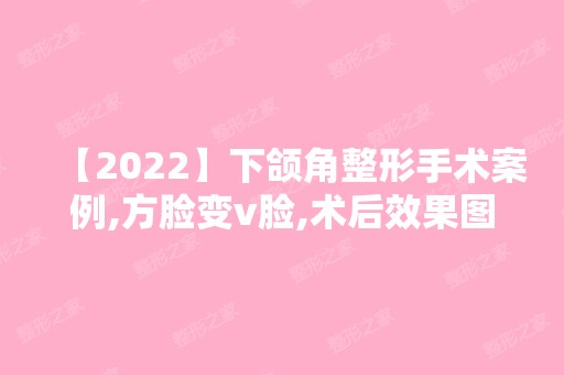 【2024】下颌角整形手术案例,方脸变v脸,术后效果图一览