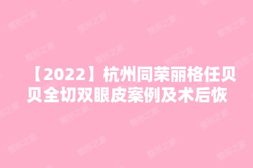 【2024】杭州同荣丽格任贝贝全切双眼皮案例及术后恢复效果分享