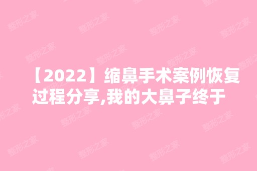 【2024】缩鼻手术案例恢复过程分享,我的大鼻子终于有救了！