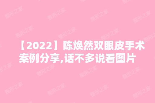 【2024】陈焕然双眼皮手术案例分享,话不多说看图片！