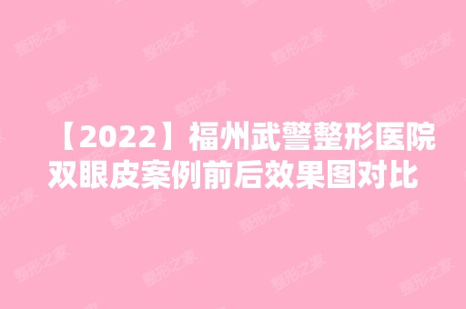 【2024】福州武警整形医院双眼皮案例前后效果图对比分享,内附整形项目价目表