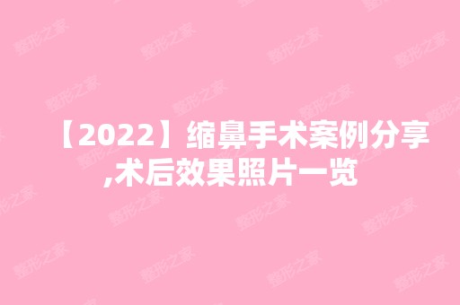 【2024】缩鼻手术案例分享,术后效果照片一览