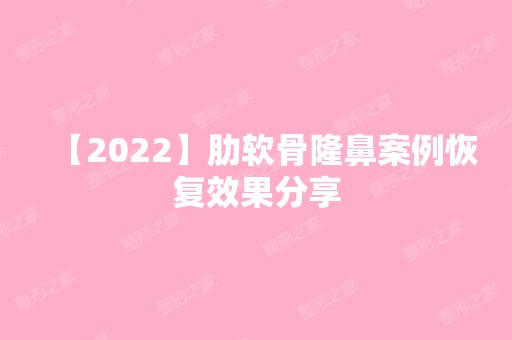 【2024】肋软骨隆鼻案例恢复效果分享