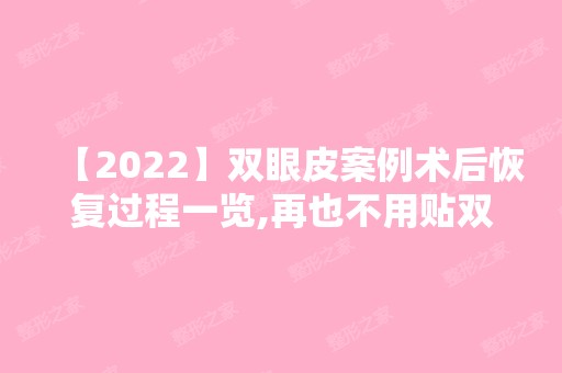 【2024】双眼皮案例术后恢复过程一览,再也不用贴双眼皮贴啦