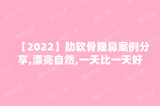 【2024】肋软骨隆鼻案例分享,漂亮自然,一天比一天好看