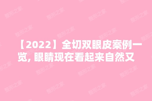 【2024】全切双眼皮案例一览, 眼睛现在看起来自然又漂亮,超开心的