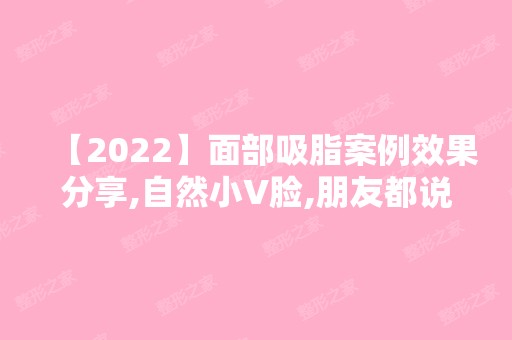 【2024】面部吸脂案例效果分享,自然小V脸,朋友都说变精致变漂亮了