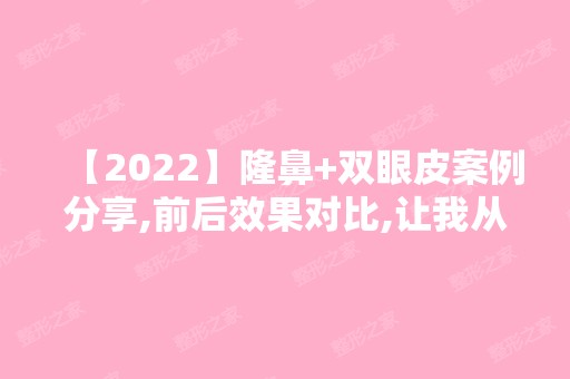 【2024】隆鼻+双眼皮案例分享,前后效果对比,让我从可爱变漂亮