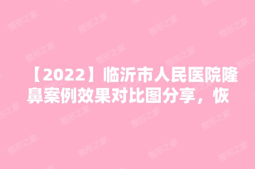 【2024】临沂市人民医院隆鼻案例效果对比图分享，恢复后鼻子挺起来，气质也变好了