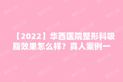 【2024】华西医院整形科吸脂效果怎么样？真人案例一览,整整瘦了20斤哦