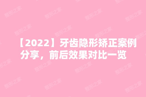 【2024】牙齿隐形矫正案例分享，前后效果对比一览