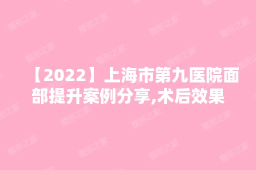 【2024】上海市第九医院面部提升案例分享,术后效果展示，一起看看吧