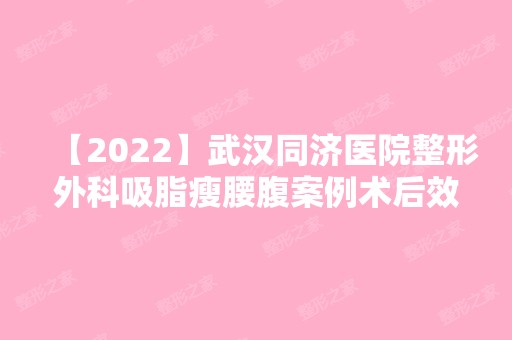 【2024】武汉同济医院整形外科吸脂瘦腰腹案例术后效果分享 术后三个月拥有小蛮腰