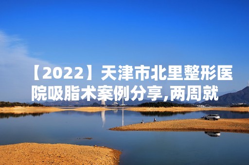 【2024】天津市北里整形医院吸脂术案例分享,两周就变筷子腿，恢复效果杠杠的