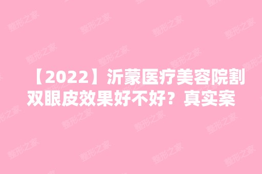 【2024】沂蒙医疗美容院割双眼皮效果好不好？真实案例分享+前后效果图对比