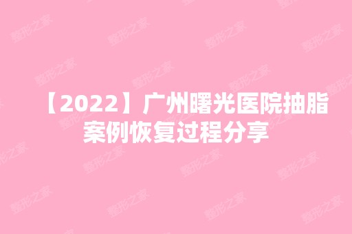 【2024】广州曙光医院抽脂案例恢复过程分享