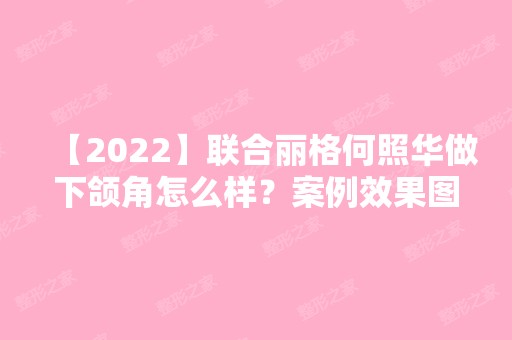 【2024】联合丽格何照华做下颌角怎么样？案例效果图+价格表