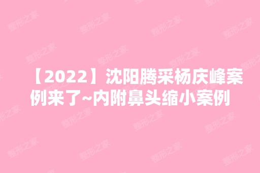 【2024】沈阳腾采杨庆峰案例来了~内附鼻头缩小案例图！