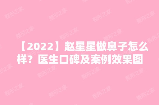 【2024】赵星星做鼻子怎么样？医生口碑及案例效果图~