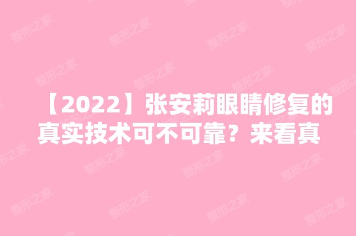 【2024】张安莉眼睛修复的真实技术可不可靠？来看真实的效果吧