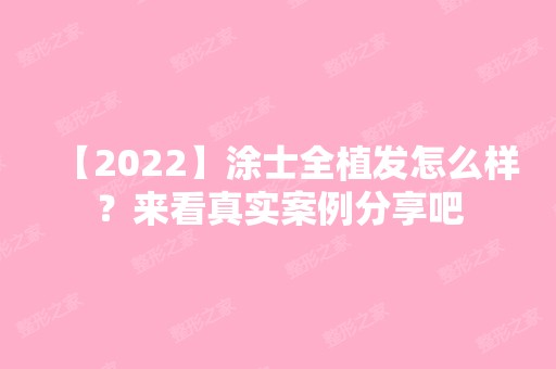 【2024】涂士全植发怎么样？来看真实案例分享吧