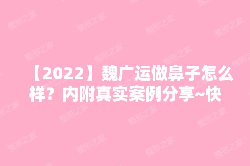 【2024】魏广运做鼻子怎么样？内附真实案例分享~快来看