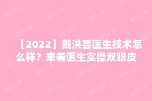 【2024】戴洪芸医生技术怎么样？来看医生实操双眼皮效果图吧