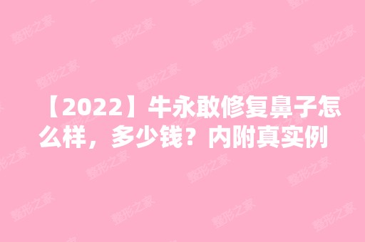 【2024】牛永敢修复鼻子怎么样，多少钱？内附真实例子分享