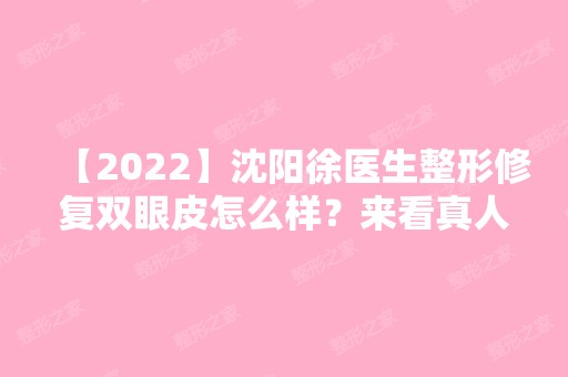 【2024】沈阳徐医生整形修复双眼皮怎么样？来看真人案例